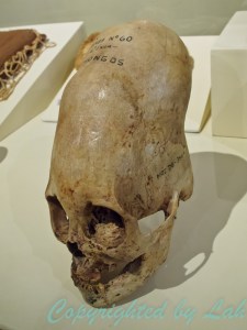 มนุษย์หัวกระโหลกยาว ปริศนาของอารยธรรมนาสก้า